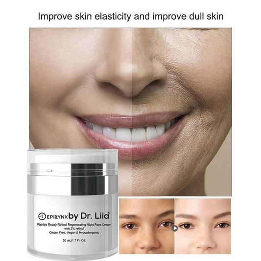 Wrinkle Repair Retinol Night Cream – Vegan, Gluten-Free, Regenerating Anti-Aging Moisturizer Face Creams EpiLynx