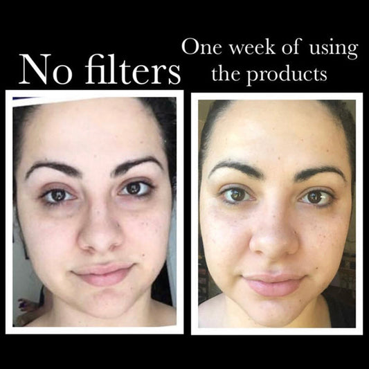 TEEK - SkinSanity® Youth Restore Regimen SKINCARE TEEK BCB