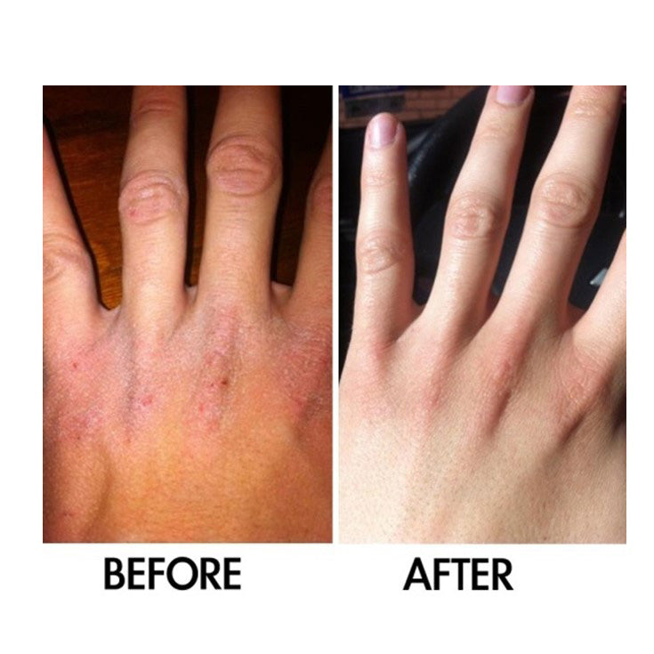 TEEK - SkinSanity® Intensive Body Lotion 3.38 fl oz SKINCARE TEEK BCB