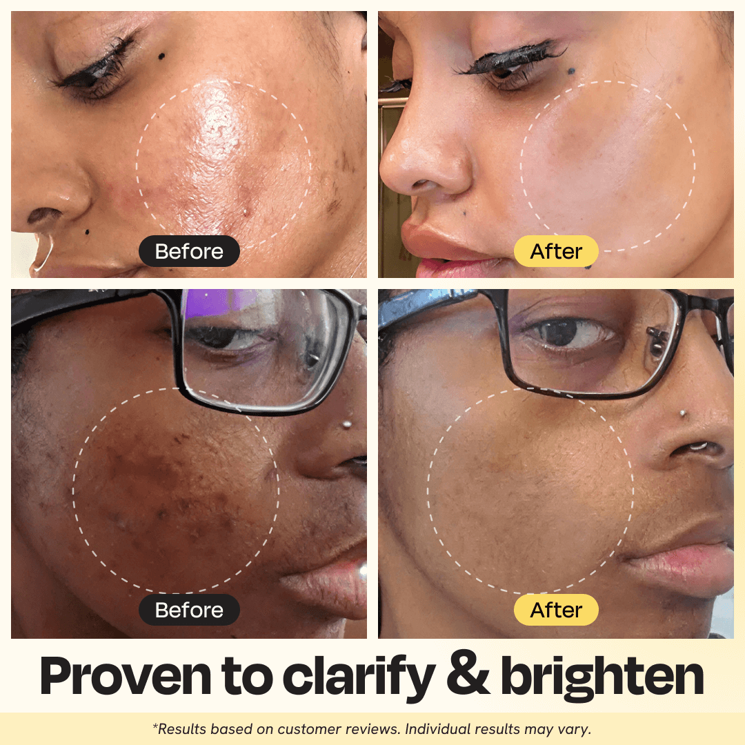 Vitamin C Clay Mask Face Mask Gleamin