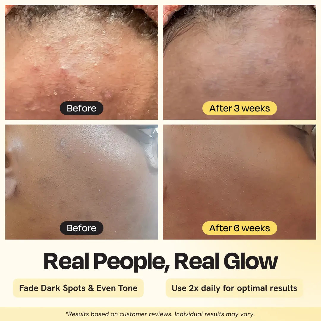 TEEK - Advanced Brightening Moisturizer Facial Moisturizer Gleamin