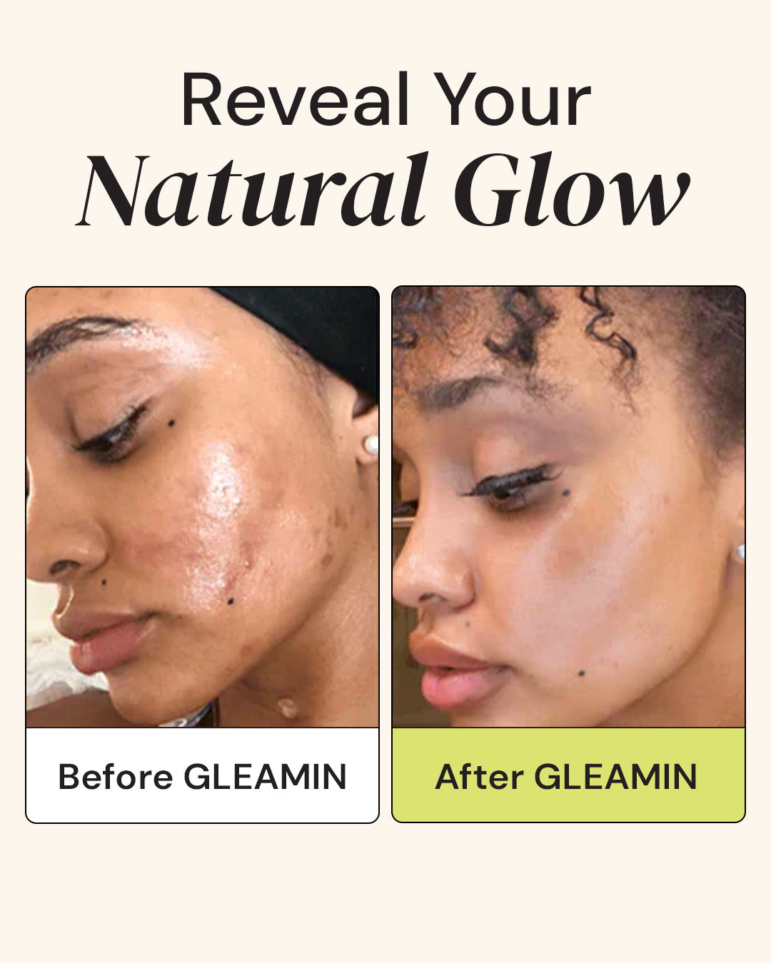 TEEK - Vitamin C Clay Mask - GLEAMIN FACIAL SUPPLIES TEEK GL