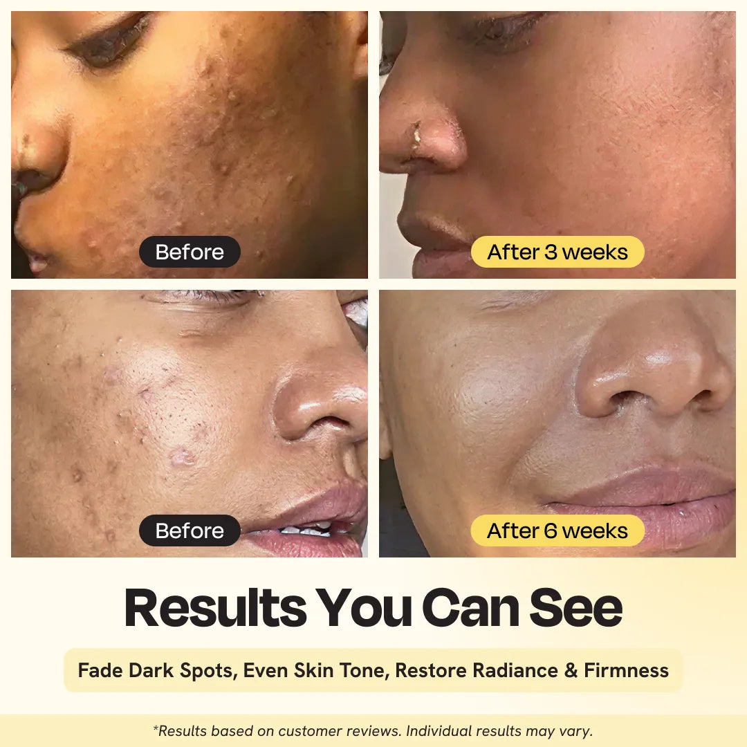 TEEK - Superactive Serum